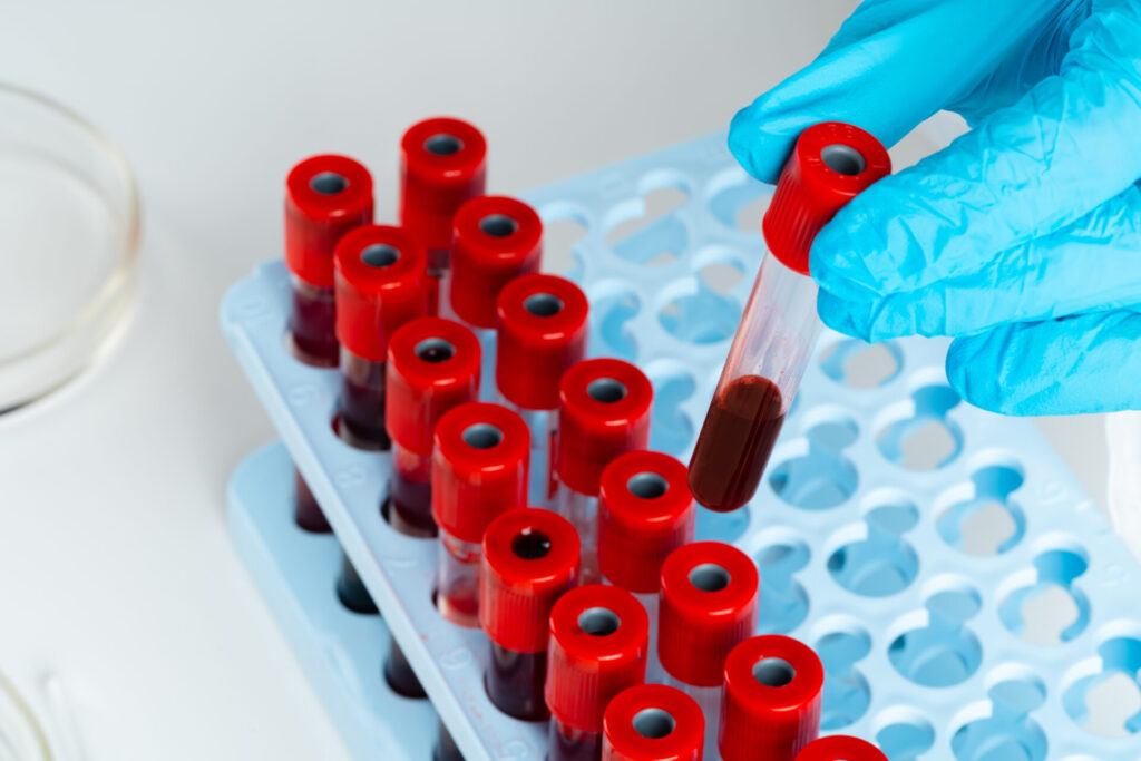 doctor 39 s hands in blue gloves keep test tube w 2026 01 09 06 36 55 utc