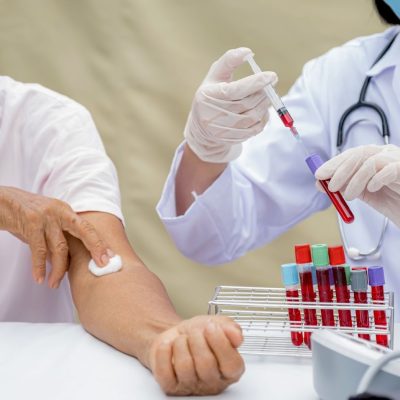 blood drawing for blood test screening